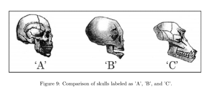 Comparison of skulls labeled as ’A’, ’B’, and ’C’.